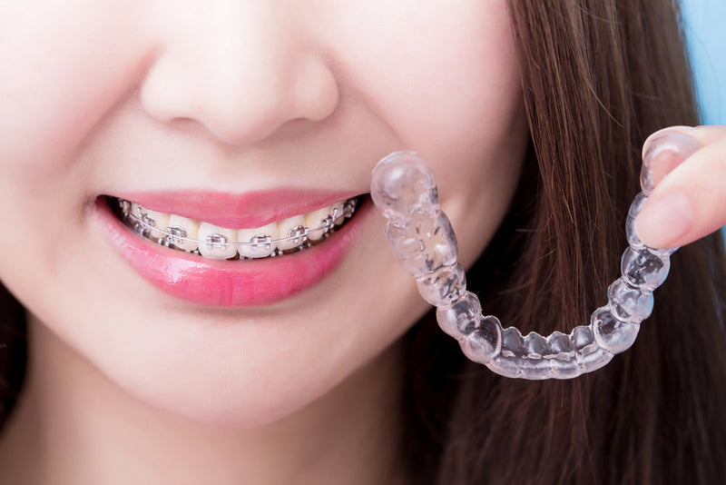 orthodontic braces on teeth